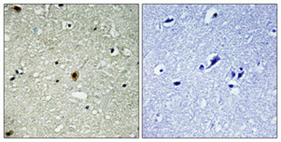 HIRA (phospho Thr555) rabbit pAb – Figure 1 of 2