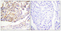 Vav rabbit pAb – Figure 1 of 2