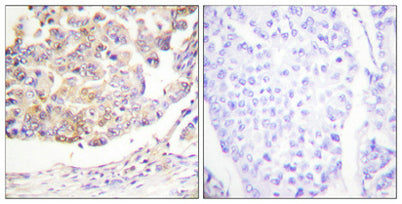 Vav rabbit pAb – Figure 1 of 2