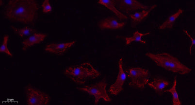 VEGF-A rabbit pAb – Figure 1 of 1