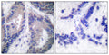 COL18A1 rabbit pAb – Figure 1 of 1