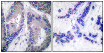 COL18A1 rabbit pAb – Figure 1 of 1