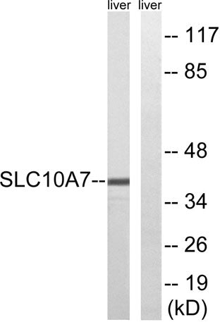 Western blot analysis of lysates from mouse liver, using SLC10A7 Antibody. The lane on the right is blocked with the synthesized peptide.