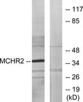 Western blot analysis of lysates from HUVEC cells, using MCHR2 Antibody. The lane on the right is blocked with the synthesized peptide.