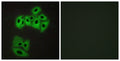 Immunofluorescence analysis of A549 cells, using VAMP4 Antibody. The picture on the right is blocked with the synthesized peptide.