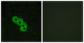 Immunofluorescence analysis of MCF7 cells, using GPR109 Antibody. The picture on the right is blocked with the synthesized peptide.