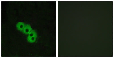 Immunofluorescence analysis of MCF7 cells, using GPR109 Antibody. The picture on the right is blocked with the synthesized peptide.