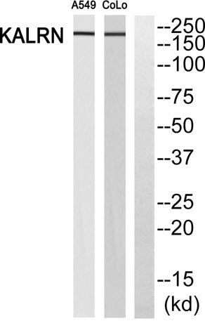 Western blot analysis of KALRN Antibody. The lane on the right is blocked with the KALRN peptide.