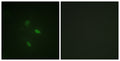 Immunofluorescence analysis of NIH/3T3 cells, using Cyclin E2 Antibody. The picture on the right is blocked with the synthesized peptide.