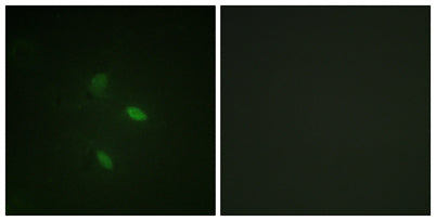 Immunofluorescence analysis of NIH/3T3 cells, using Cyclin E2 Antibody. The picture on the right is blocked with the synthesized peptide.