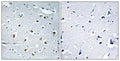 Immunohistochemical analysis of paraffin-embedded Human brain.