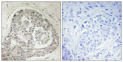 KIAA0100 rabbit pAb – Figure 1 of 1