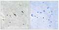 Immunohistochemistry analysis of paraffin-embedded human brain, using Gab2 (Phospho-Tyr643) Antibody. The picture on the right is blocked with the phospho peptide.