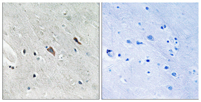 Immunohistochemistry analysis of paraffin-embedded human brain, using Gab2 (Phospho-Tyr643) Antibody. The picture on the right is blocked with the phospho peptide.