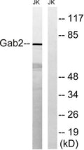 Western blot analysis of lysates from Jurkat cells, treated with TNF 2500U/ml 30', using Gab2 Antibody. The lane on the right is blocked with the synthesized peptide.