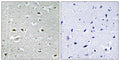 Immunohistochemistry analysis of paraffin-embedded human brain, using URB1 Antibody. The picture on the right is blocked with the synthesized peptide.