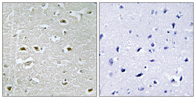 Immunohistochemistry analysis of paraffin-embedded human brain, using URB1 Antibody. The picture on the right is blocked with the synthesized peptide.