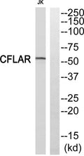 Western blot analysis of CDC5L Antibody. The lane on the right is blocked with the CDC5L peptide.