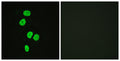 Immunofluorescence analysis of HeLa cells, using AS160 Antibody. The picture on the right is blocked with the synthesized peptide.