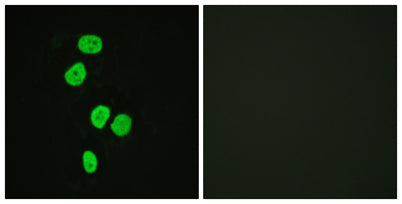 Immunofluorescence analysis of HeLa cells, using AS160 Antibody. The picture on the right is blocked with the synthesized peptide.