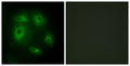 Immunofluorescence analysis of HeLa cells, using DLEC1 Antibody. The picture on the right is blocked with the synthesized peptide.