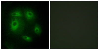 Immunofluorescence analysis of HeLa cells, using DLEC1 Antibody. The picture on the right is blocked with the synthesized peptide.