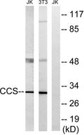 Western blot analysis of lysates from NIH/3T3 and Jurkat cells, using CCS Antibody. The lane on the right is blocked with the synthesized peptide.