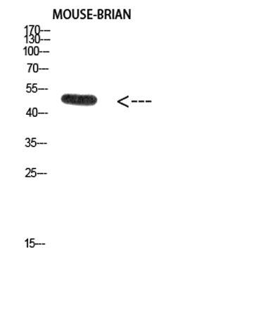 Western Blot analysis of MOUSE-BRIAN cells using Antibody diluted at 2000. Secondary antibody(catalog#:RS0002) was diluted at 1:20000