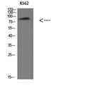 Western Blot analysis of K562 cells using Villin Polyclonal Antibody diluted at 1:500. Secondary antibody(catalog#:RS0002) was diluted at 1:20000