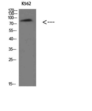 Western Blot analysis of K562 cells using Villin Polyclonal Antibody diluted at 1:500. Secondary antibody(catalog#:RS0002) was diluted at 1:20000