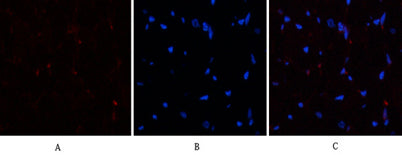 Immunofluorescence analysis of human-heart tissue. 1,PTEN Polyclonal Antibody(red) was diluted at 1:200(4°C,overnight). 2, Cy3 labled Secondary antibody was diluted at 1:300(room temperature, 50min).3, Picture B: DAPI(blue) 10min. Picture A:Target. Picture B: DAPI. Picture C: merge of A+B