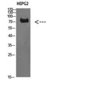 Western Blot analysis of HEPG2 cells using TRIF Polyclonal Antibody diluted at 1:1000. Secondary antibody(catalog#:RS0002) was diluted at 1:20000