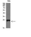 Western Blot analysis of Hela cells using PTH-rP Polyclonal Antibody diluted at 1:800. Secondary antibody(catalog#:RS0002) was diluted at 1:20000