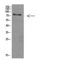 Western Blot analysis of HEPG2 cells using Antibody diluted at 800. Secondary antibody(catalog#:RS0002) was diluted at 1:20000