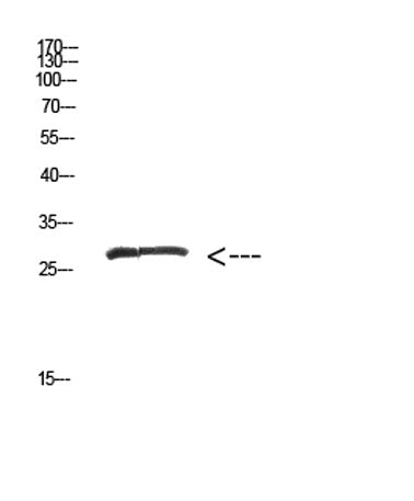 Western Blot analysis of hepg2 cells using Antibody diluted at 500. Secondary antibody(catalog#:RS0002) was diluted at 1:20000