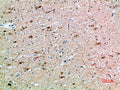 FSHβ rabbit pAb – Figure 1 of 2