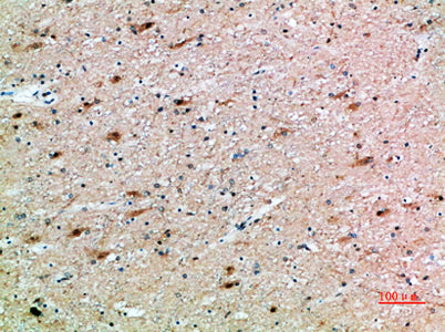 FSHβ rabbit pAb – Figure 1 of 2
