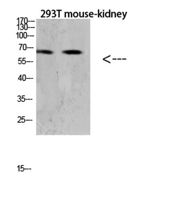 Western blot analysis of Hela lysate, antibody was diluted at 1000. Secondary antibody(catalog#:RS0002) was diluted at 1:20000