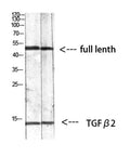 Western blot analysis of mouse-kidney 293T mouse-lung lysate, antibody was diluted at 1000. Secondary antibody(catalog#:RS0002) was diluted at 1:20000