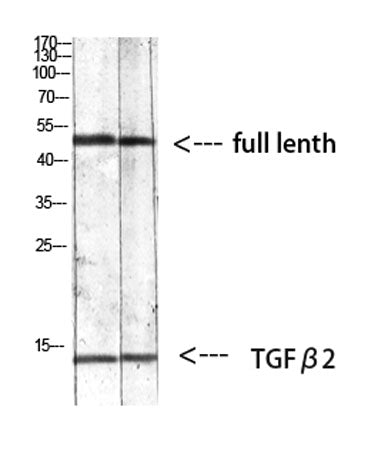 Western blot analysis of mouse-kidney 293T mouse-lung lysate, antibody was diluted at 1000. Secondary antibody(catalog#:RS0002) was diluted at 1:20000