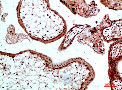 Ub rabbit pAb – Figure 1 of 2
