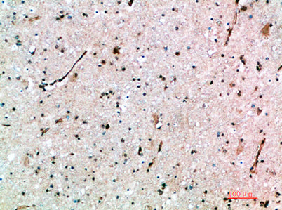 AVP Receptor V3 rabbit pAb – Figure 1 of 1