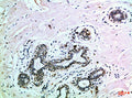 Immunohistochemical analysis of paraffin-embedded Human-breast, antibody was diluted at 1:100