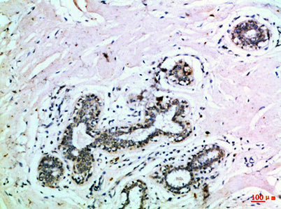 Immunohistochemical analysis of paraffin-embedded Human-breast, antibody was diluted at 1:100