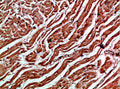Immunohistochemical analysis of paraffin-embedded Human-heart, antibody was diluted at 1:100
