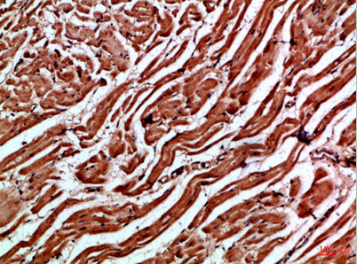 Immunohistochemical analysis of paraffin-embedded Human-heart, antibody was diluted at 1:100