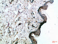 Frizzled-4 rabbit pAb – Figure 1 of 3