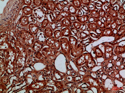 EYA1/EYA4 rabbit pAb – Figure 1 of 4