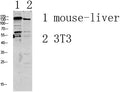 Western blot analysis of various lysate, antibody was diluted at 1000. Secondary antibody(catalog#:RS0002) was diluted at 1:20000