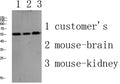 Western blot analysis of various lysate, antibody was diluted at 1000. Secondary antibody(catalog#:RS0002) was diluted at 1:20000